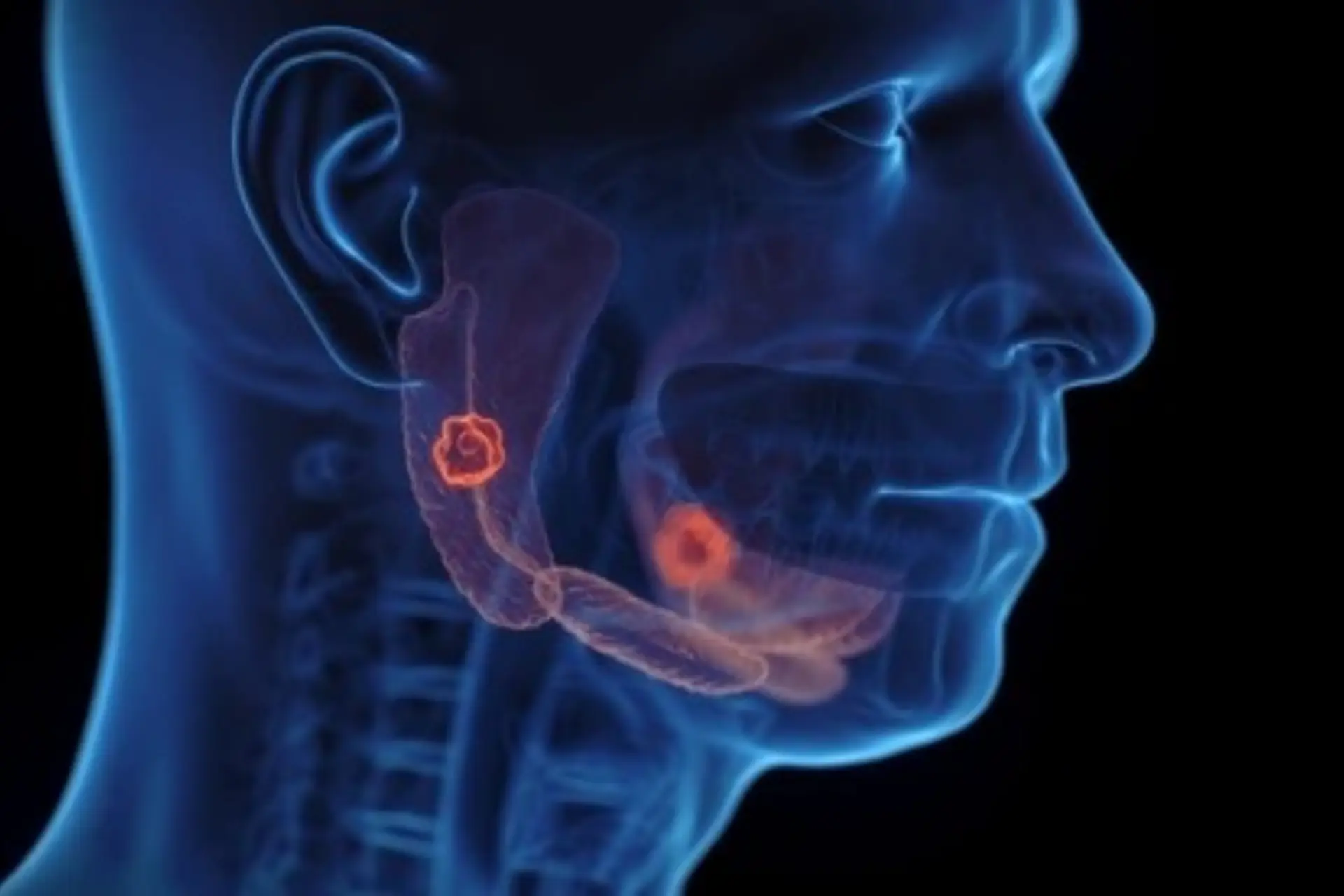 Salivary Gland Cancer Surgeon in HRBR Layout, Bangalore